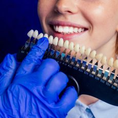 רופא שיניים עובד על כתר במעבדת שיניים ובוחן את צבע השיניים מול פלטה
